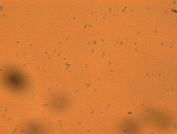 A mutant bacterial strain of Lactobacillus pentosu