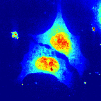 X-ray scan of biological cells