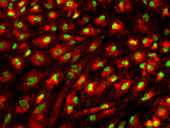 Liver cells derived from human pluripotent stem cells