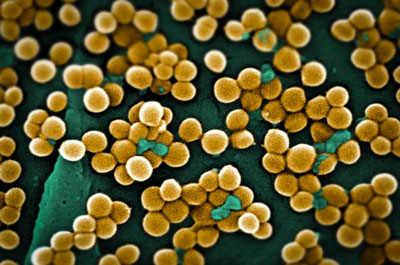 A scanning electron micrograph depicts numerous clumps of methicillin-resistant Staphylococcus aureus bacteria