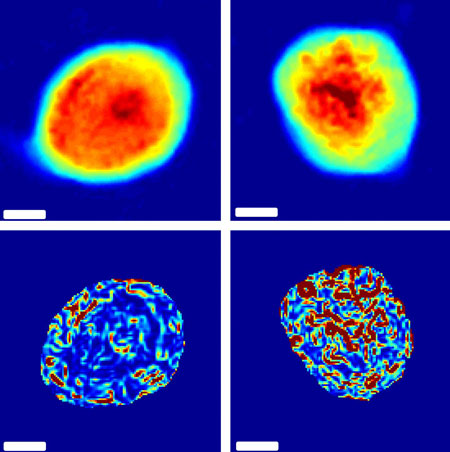 Images of cells are analyzed to calculate the level of disorder in their internal structures