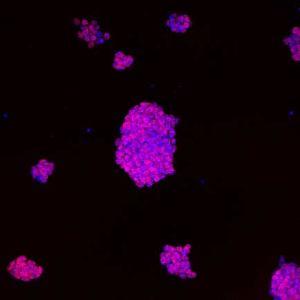 colonies of mouse embryonic stem cells