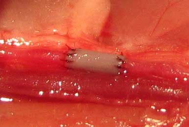 Successful implantation of collagen tube into a rat’s femoral artery