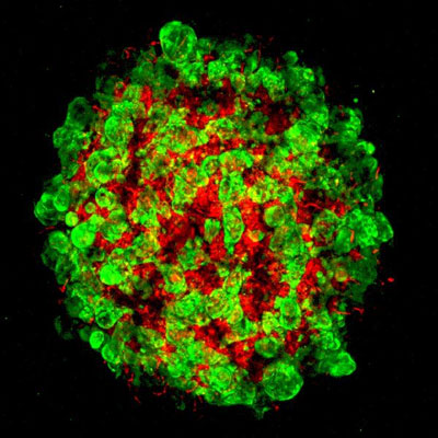 detailed development of a human liver organoid that was tissue-engineered