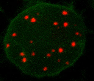Living nucleus of the plant Nicotiana benthamiana shows red fluorescent labelled telomere sequences