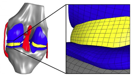 finite element model of the knee joint with representation of the cartilage, menisci and the associated bone structures