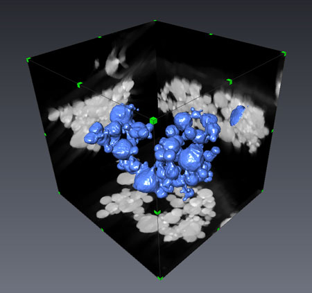 high-resolution 3-D electron microscopy reconstruction of aluminum nanoparticles