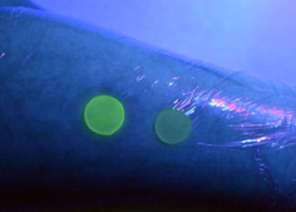 glowing wound dressing
