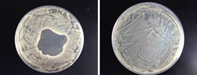 antibacterial hydrogel coated onto the center of a Petri dish