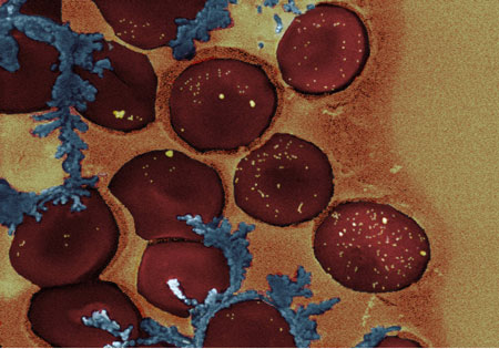 A colorized electron micrograph of red blood cells with gold nanorods