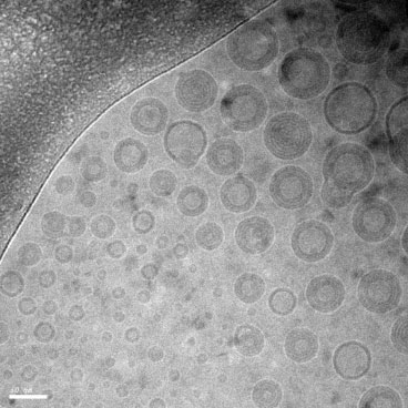 Cryoelectron microscope image of nanoparticles