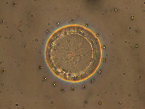 A submerged micropost causes the surrounding liquid crystal to form a ring pattern, directing nanoparticles on the surface