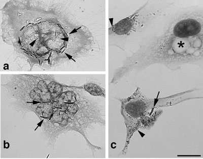 Morphology of H596 lung carcinoma cells exposed to TiO2-based nanofilaments