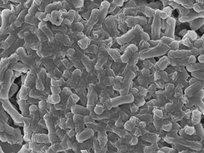 E. coli after incubation with single-walled carbon nanotubes