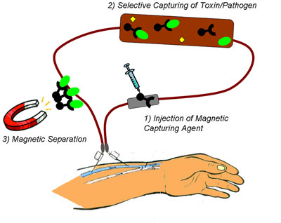 Schematic depiction of the process of pathogen removal from the blood using nanomagnets
