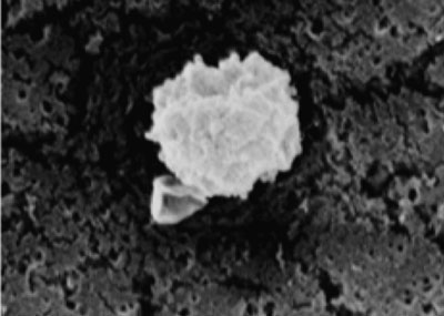 scanning electron microscopy, showing a chitosan-alginate nanoparticle measuring 226 nm after being exposed to water