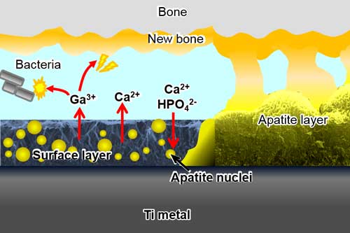 bioactive titanium slowly releases Ga3+ ions to inhibit adhesion and proliferation of bacteria while at the same time stimulating new bone formation