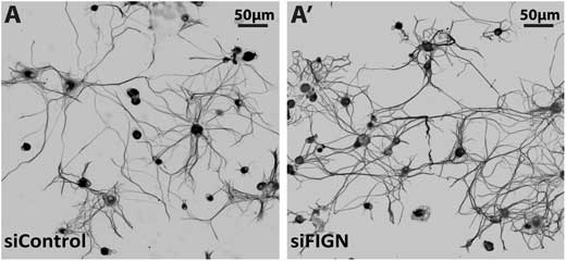 Microtubule mass is increased in the axons of adult DRG neurons as a result of fidgetin knockdown