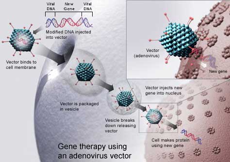Example for viral gene therapy using an Adenovirus vector