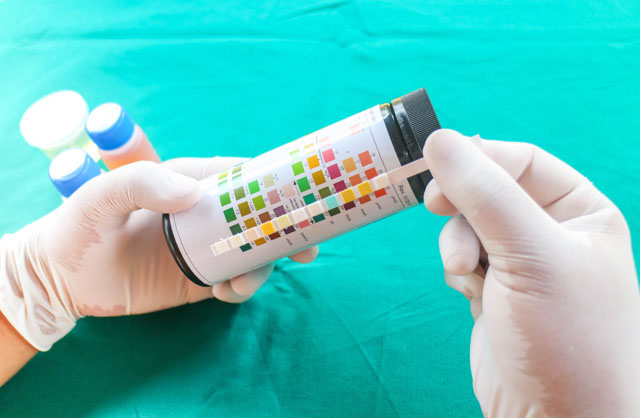 colored test strips