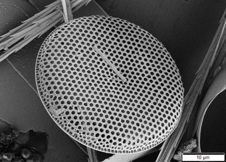 Scanning electron microscope image of a marine diatom