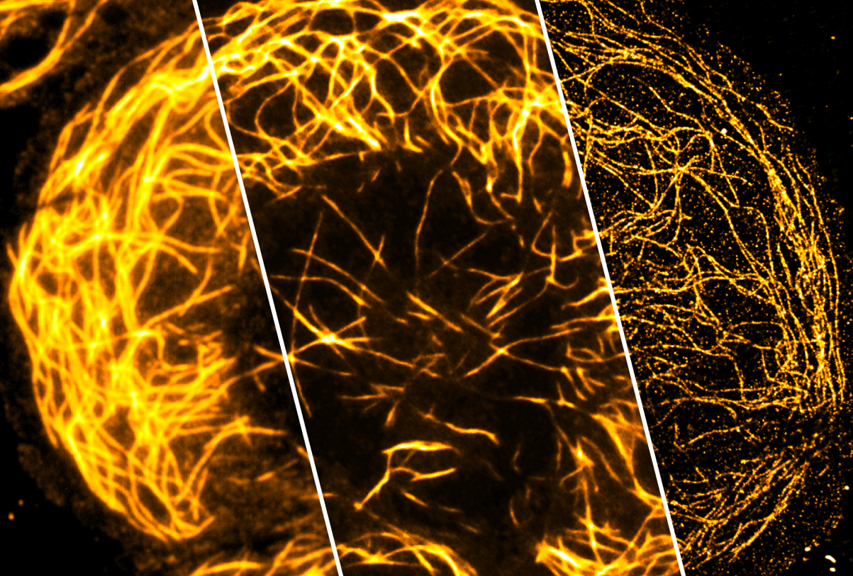This image illustrates the concept of nanoscopy, where nanoscale structures are imaged with high resolution