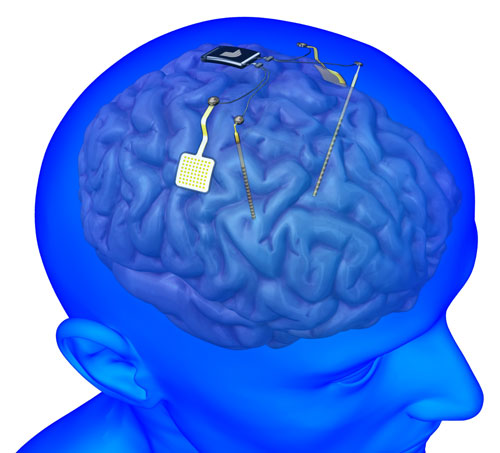 neural device capable of recording and stimulating the human central nervous system