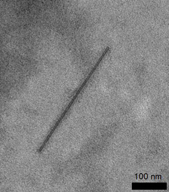 An electron micrograph of a protein filament