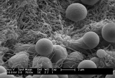 Hemostatic Nanoparticles