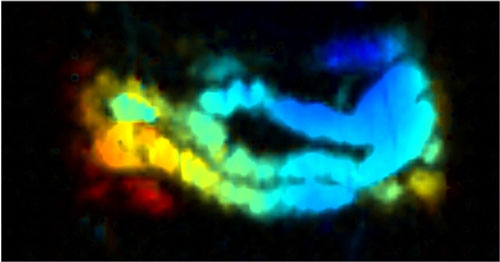  photoacoustic image of a mouse intestine