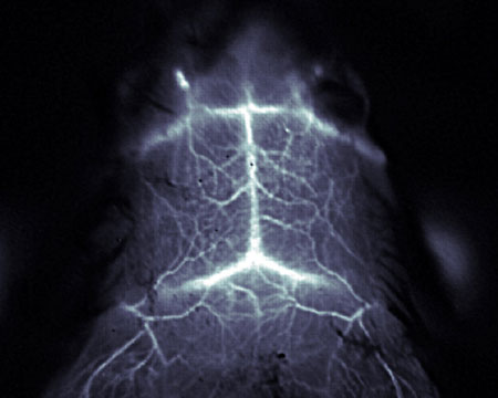 Fluorescent image