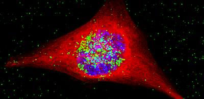 Cancer Cell with Nanoparticles