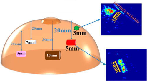electronic skin for breast cancer screening