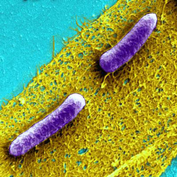 Biofilms