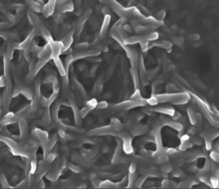 Gel Scaffold Structure