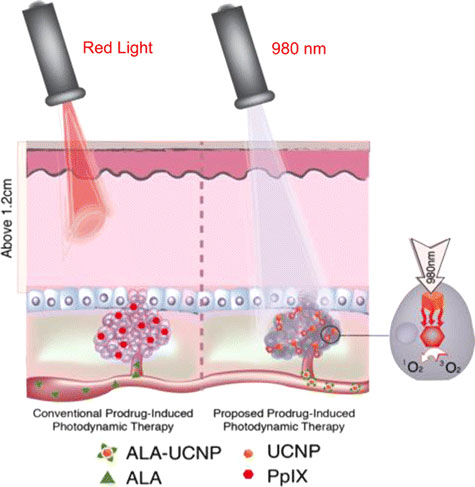 photodynamic therapy with upconverting nanoparticles