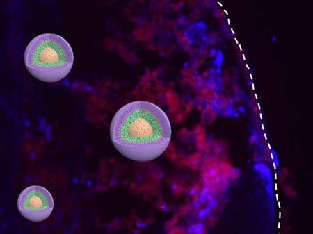 nanomedicine
