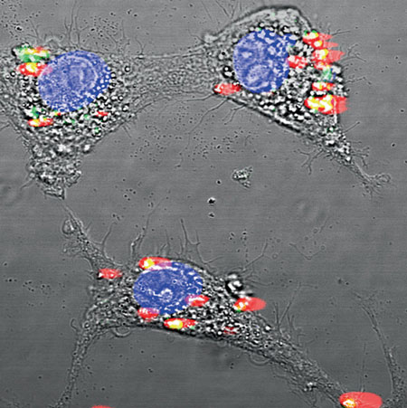 Rare-earth nanoparticles encapsulated in albumin shells glow under infrared light