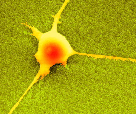 Scanning electron micrograph showing a neuron on a nanorough surface