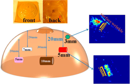Electronic skin could improve early breast cancer detection