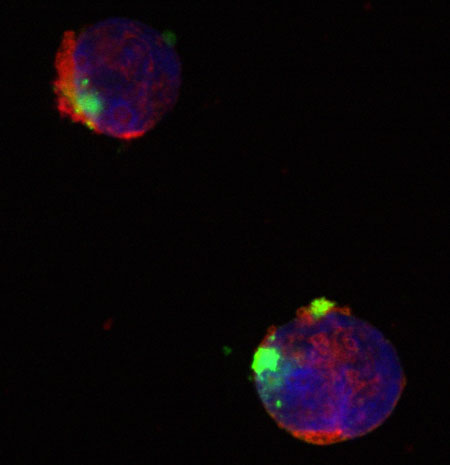Leukemic cells under attack by a 'smart bomb'