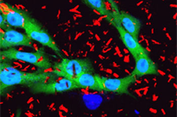 Confocal Mikroskopie-Aufnahme von Silizium-Nanopartikeln in tierischen Zellen