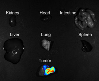 LundIntravenous administration of a hybrid metal–polymer nanoprobe causes tumor tissue to fluoresce
