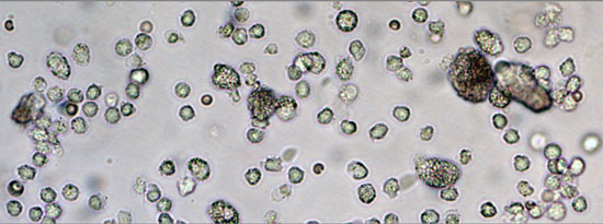 A microscope image shows many of the immune system's dendritic cells that were collected from a 3D scaffold