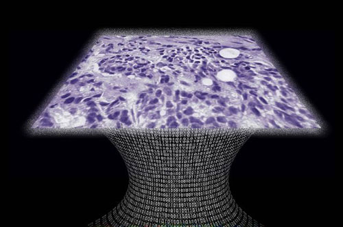 Tissue sample image created by a new lens-free microscope