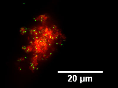 >Laser confocal scattering image of a HeLa cells cultured with EGF-Nanospheres