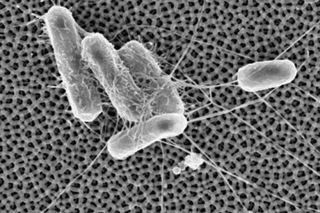 The nanoporous surface alumina repels E. coli cells