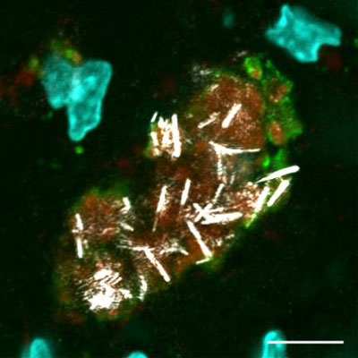 nanowires