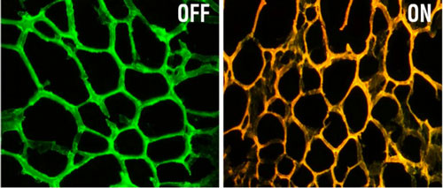 hydrogel embedded with gold nanoparticles coated with DNA targeting a gene called MRP-1