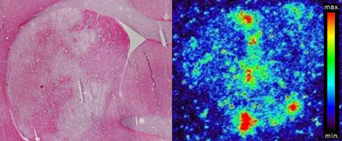 Autoradiograph of a brain section of a laboratory mouse after a Stroke